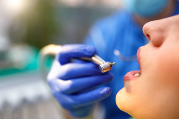 Why Choose Us for Your Dental Needs in Asbury Lake, FL